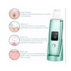 Limpiador Facial Skin Scrubber Peeling Ultrasónico Portátil Verde