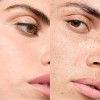 Tratamiento Vichy Normaderm Doble Corrección 50ml