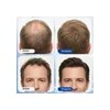 Suero Capilar Para Crecimiento Cabello 3% Romero 1.01 Oz
