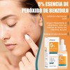 Sérum Peróxido Benzoilo 5% Eliminar La Cabeza Negra Del Acné
