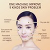 RF Radio Frequency Dot Matrix Face Tightening Rejuvenation Skin Beauty