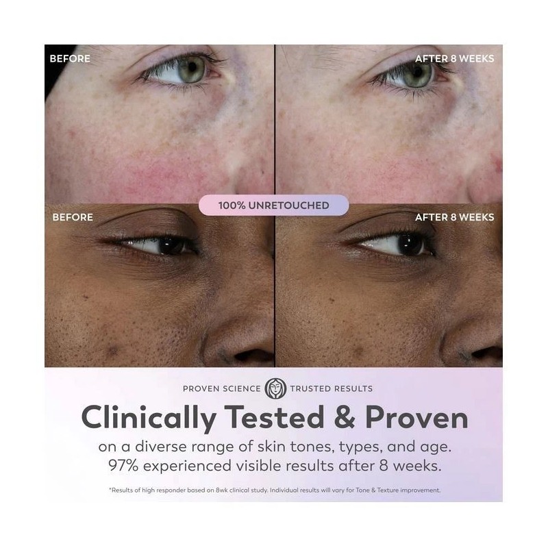 Olay Super Serum - Niacinamide, Vitamin C & E, Collagen