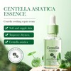 Centella Asiatica Beruhigendes Serum & Feuchtigkeitscreme Duo, Intensiv Regenerierend Für