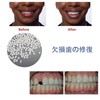 ALLVD Dental Resin Denture Repair Kit, Temporary Denture Replacement Kit,