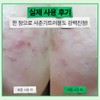 Epilow 어성초 히알루시카 트러블 진정 초밀착 토너 패드 100매 Himalaya