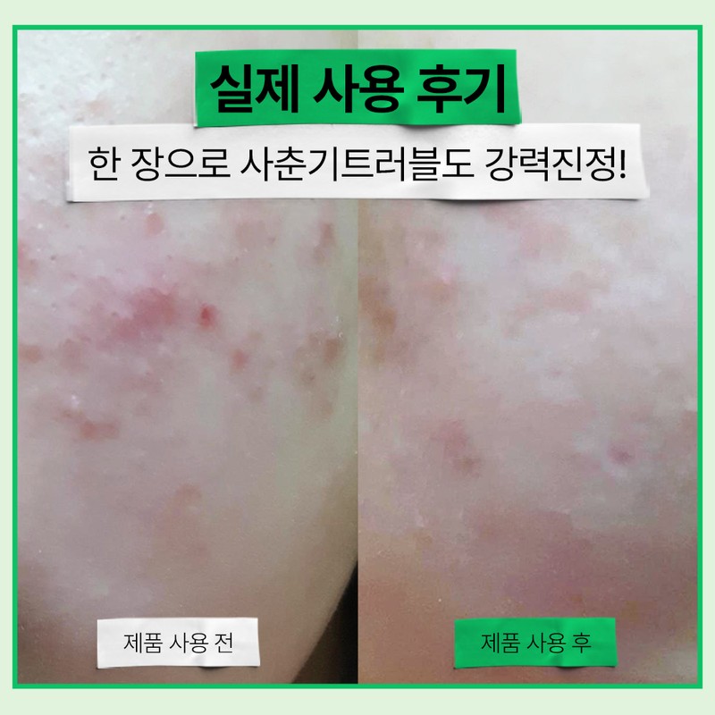 Epilow 어성초 히알루시카 트러블 진정 초밀착 토너 패드 100매 Himalaya
