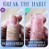 10 Pcs Anti Skin Picking Fidget Toys Silicone Finger Sleeve