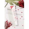 Crema Anti Acné Natural Con Extractos De 9 Plantas Y