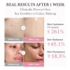 Medicube Pdrn Pink Collagen Bubble Serum Hydrating Face Serum for