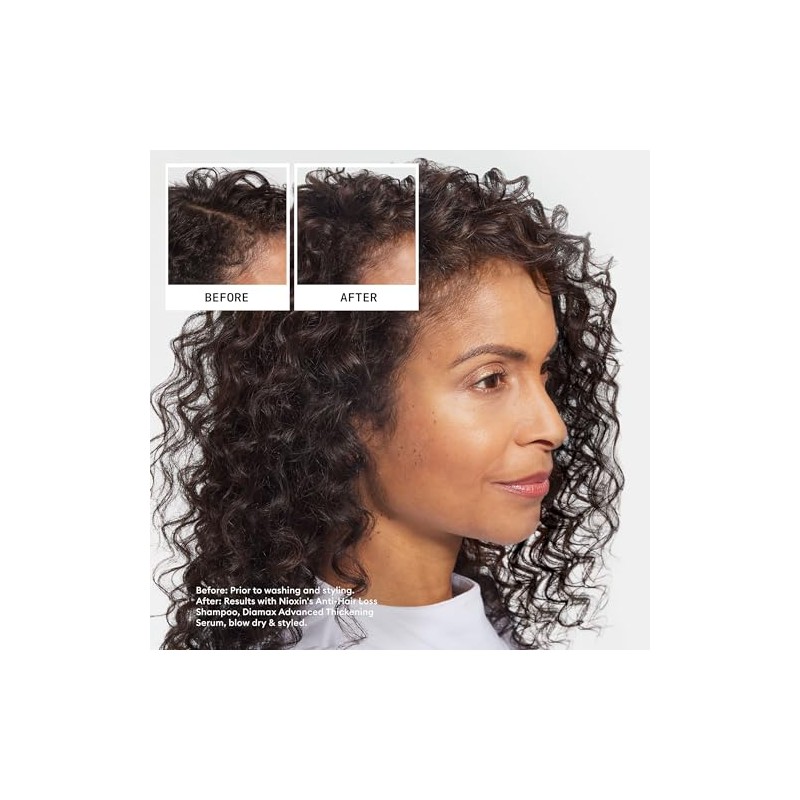 Nioxin Shampoo Defensa Anticaída 240ml