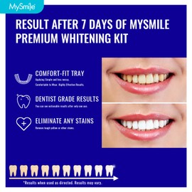 MySmile 7 Treatments Prefilled Teeth Whitening Trays Kit with 12% Hydrogen Peroxide Whiter Gel for Sensitive Tooth, Fast-Result Vegan Teeth Whitener Tooth Stain Remover, Mint Flavor