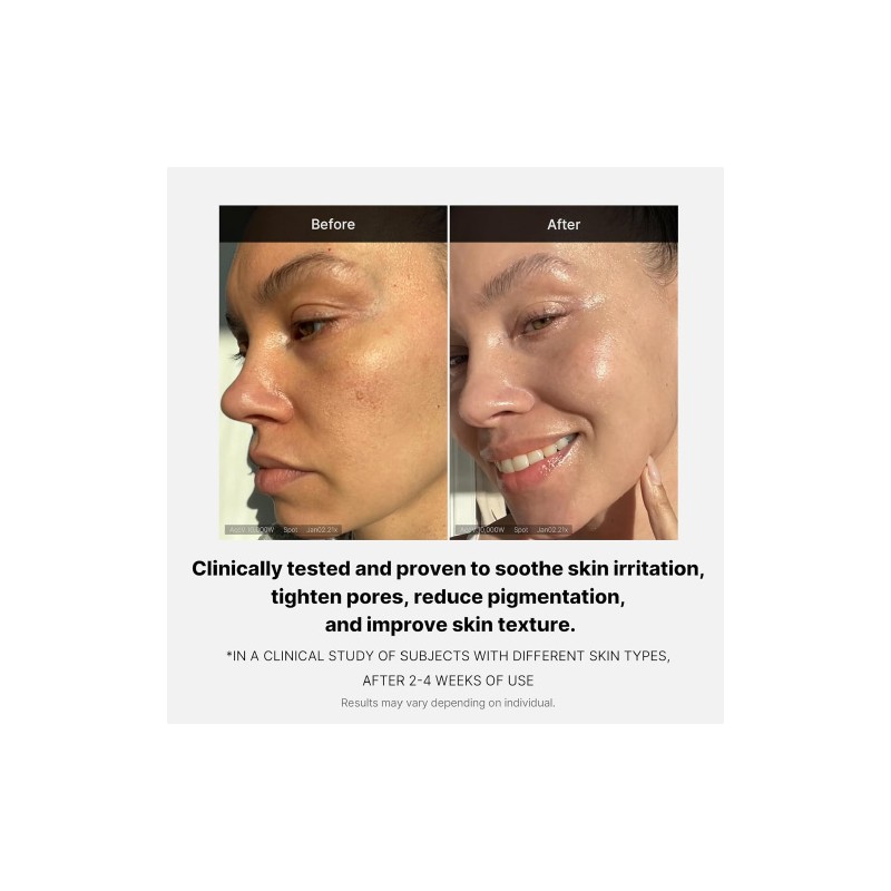 MEDICUBE [MEDICUBE]Triple Collagen Cream 4.0 50ml