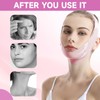 Chin Strap for Sleeping,Reusable V Line Lifting Chin Strap,Jaw Strap,Chin