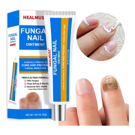 Crema Fúngica Uñas Tolnaftato 1%, Hongos En Uñas Infeccion