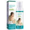 IZBEAUVO - Back Acne Treatment, Back & Body Acne Treatment