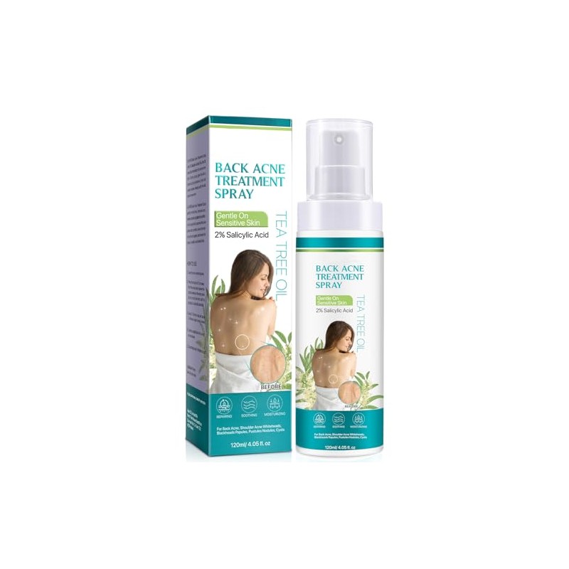 IZBEAUVO - Back Acne Treatment, Back & Body Acne Treatment