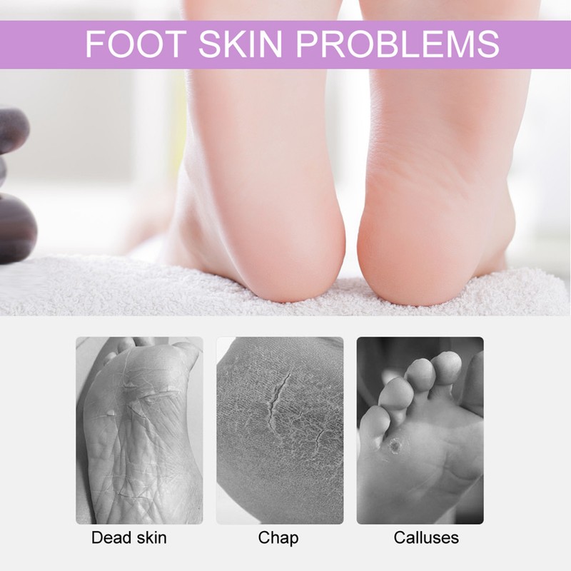 Rechargeable Electric Foot Callus Remover Exfoliate Dead Skin Removal Foot