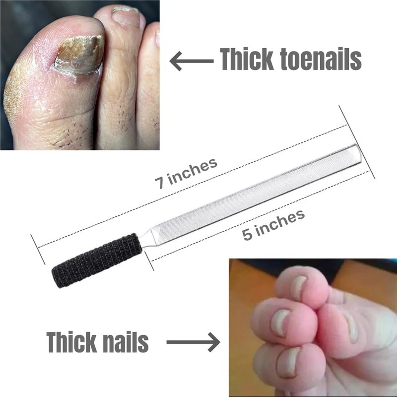 IDOU Toenail Files for Thick Nails, Stainless Steel, 4 Sides,