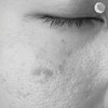 Dr. Rimpler Brightening tonic - clarifying tonic for pigment-disturbed skin