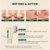 KSECRET [KSECRET]SEOUL 1988 Cleansing Foam : Pine Cica 1% +