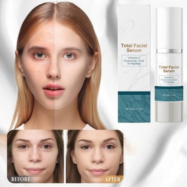 Total Facial Serum,Anti-Aging Facial Serum with Hyaluronic Acid,Serums for Face,Lifting Firming Serum,Anti-Aging Skin Care Cream,Face S/erum,Deep Hydrating Toner,Gentle Soothing Facial Lotion,30ml