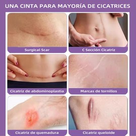 Parche de Silicona para Cicatrices y Cesárea de 3 Metros HOPEFEEL