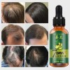 Aceite De Jengibre Para Cabello Crecimiento Contra Calvicie