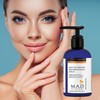 Mad Skin Care Spot On Targeted Skin Brightening Serum 120ml