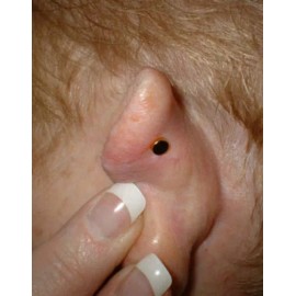 Acupressure Magnets Shelter In Place Hunger Control Acupressure Magnets One NEW Kit 2024 Success