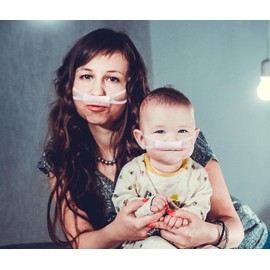 2 Pack Elastic Nose Bandage, Nose Bleed Stopper, Tape for Rhinoplasty Shaping, Rhinoplasty Recovery Supplies (2)