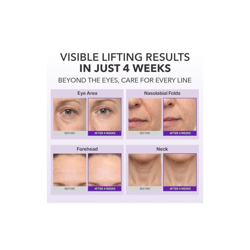 Centellian24 360 Shot Pdrn Lifting Eye Cream
