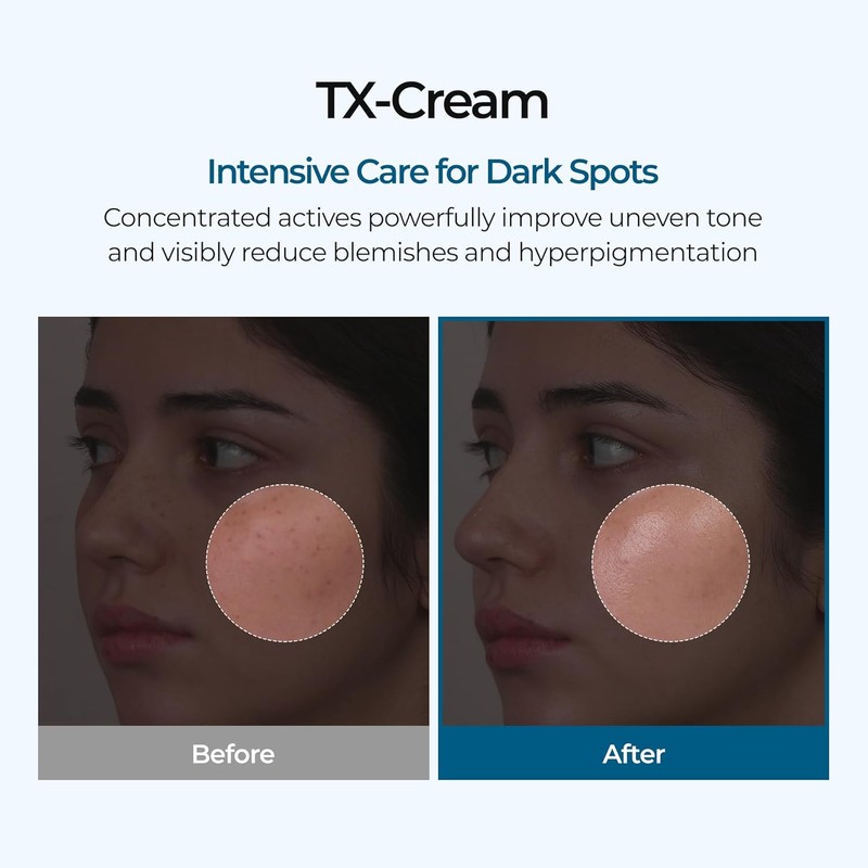 DR.melarxin Tranexamic Acid Cream 50ml | Targeted Treatment for Melasma,