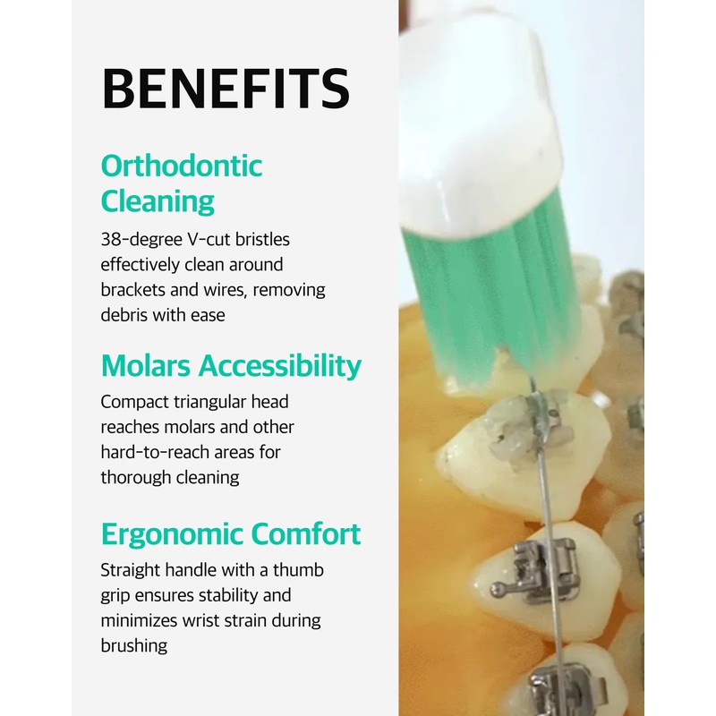 LiveOrals V-Cut Orthodontic Toothbrush(Mint) - Compact Head for Braces, Ergonomic