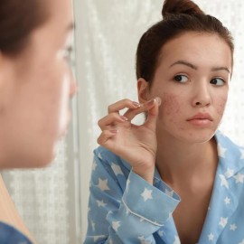 Parches Acné Fonglu Por Paquete Tamaño Ideales Brotes Zonas Extensas Absorben Impurezas Contienen Medicamentos Están Dermatológicamente Probados
