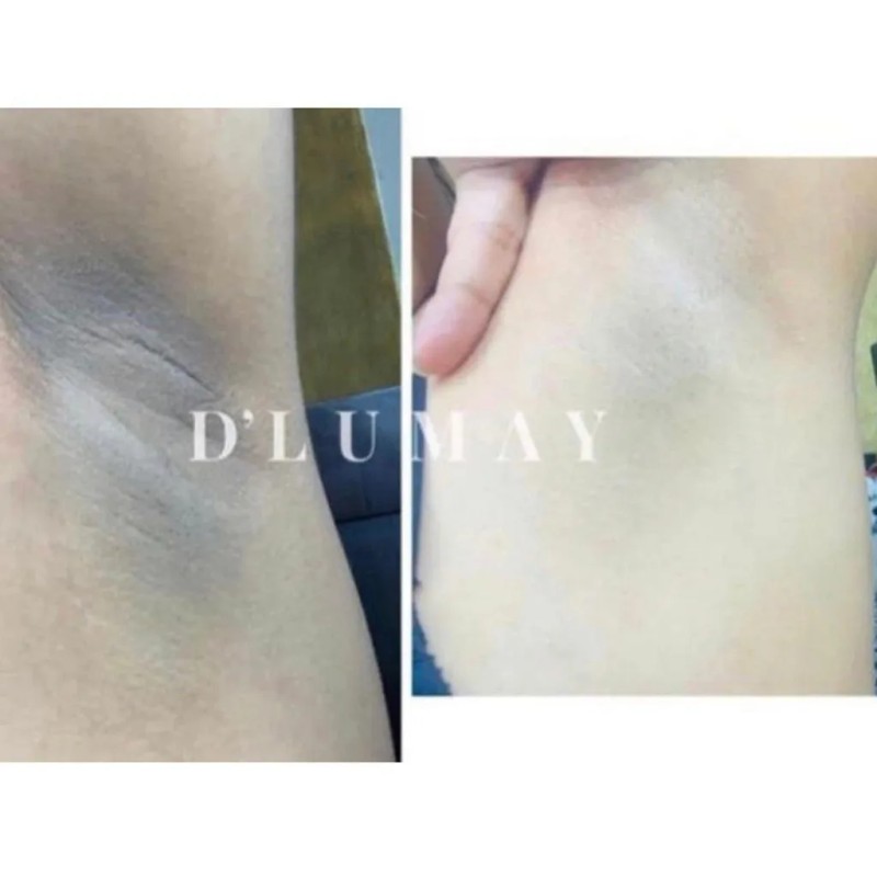 Dlumay Crema Rescue Multiaccion 30gr Piel Extra Sensible