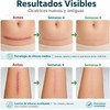 Parches Silicona para Cicatrices – Láminas Reutilizables para Cesárea y