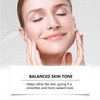 Skin Renewal Face Cream - For Melasma, Pigmentation - Supports