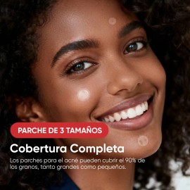 Parches Para Acné Hidrocoloide, Anti Acne Espinillas Granos