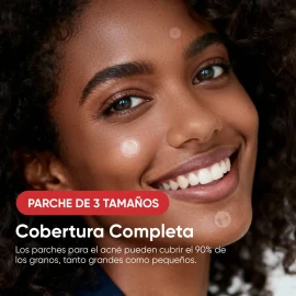 Parches Para Acné Hidrocoloide, Anti Acne Espinillas Granos