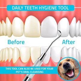 Unbranded Dental Explorer Steel Tooth Scraper Endodontic Tartar Calculus Plaque Remover