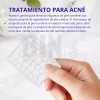 Parches Aliver Antiacné Pack 180 Unidades Día/noche Todo Tip