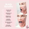 Lip Plumper Device | Non-Invasive Lip Plumping Device, Pain-Free |