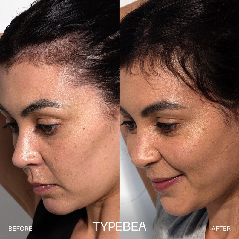 TYPEBEA G1 Overnight Boosting Peptide Serum 100ml