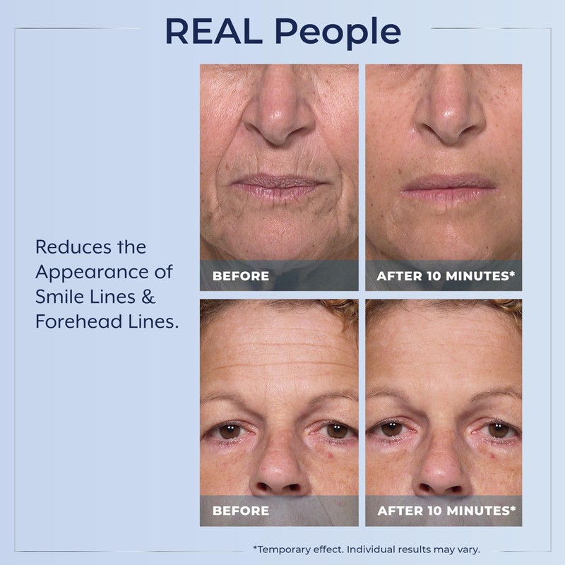 Plexaderm Rapid Reduction Eye Serum - Visibly Reduces Under-Eye Bags,