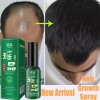 Unbranded Yao Pin Anti-Hair Loss & Hair Growth Solution Loss