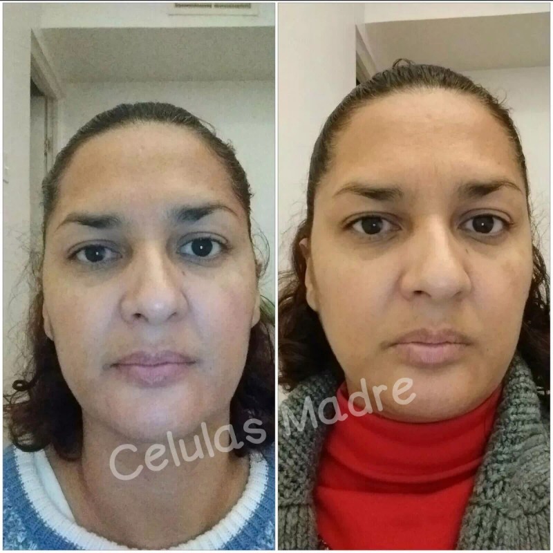 D'Ale 2 Cremas Facial Regeneradora Células Madre, Hidratante, Fps