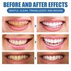 2PCS Teeth Whitening Paints,Tooth Polishing Paste,Whitening Toothpaste,Instant & Long-Lasting Results,Dual