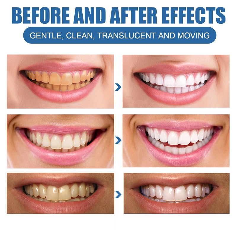 2PCS Teeth Whitening Paints,Tooth Polishing Paste,Whitening Toothpaste,Instant & Long-Lasting Results,Dual