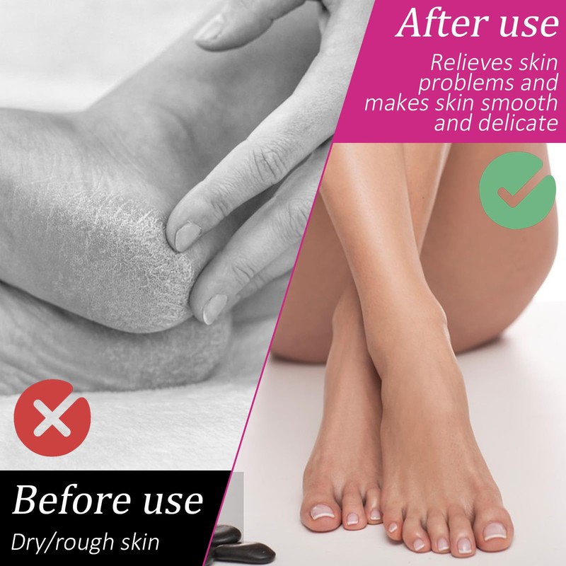 3 Pairs Moisturizing Socks Overnight for Dry Feet, Lotion Socks,