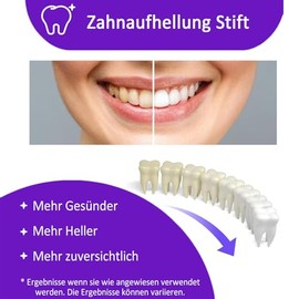 Zahnaufhellung, Zähne Aufhellen Stift, Professional Teeth Whitening Pen, Zahnweiss Bleaching Zähne Schnelles Flecken Schnell Entfernen, Effective Sofortige Farbkorrektur 3 Stück